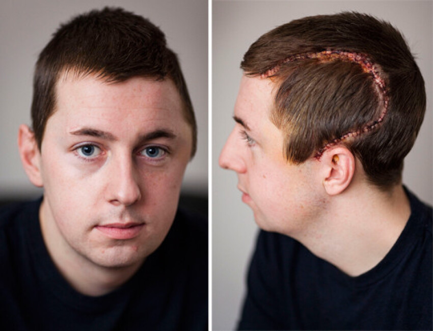 Как Выглядит Открытая Черепно Мозговая Травма Фото – Telegraph