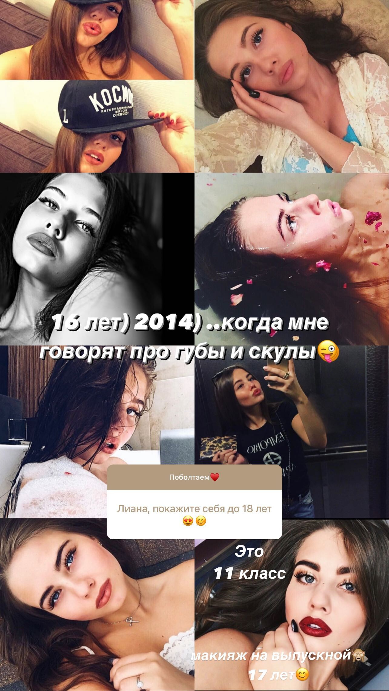 Лиана Шульгина До И После Пластики