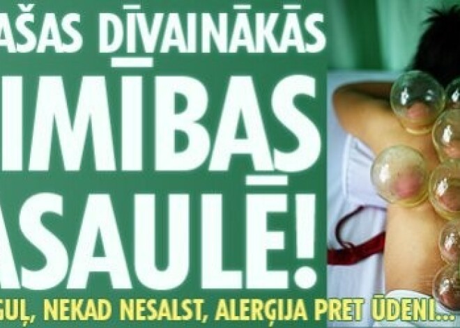 10 pašas dīvainākās slimības pasaulē!