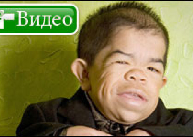 Назван самый маленький человек планеты