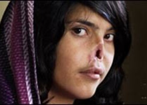 Изуродованная афганская девочка-подросток потрясла мир
