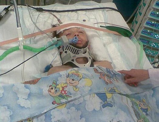 Джеймс после аварии