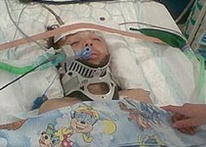 10-летнему мальчику дали лишь 5% на выживание