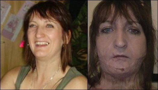 Коралл до несчастного случая и после