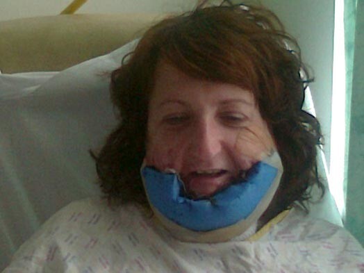 Жертве насилия пришлось пройти через мучительные пересадки и операции, чтобы она смогла выжить