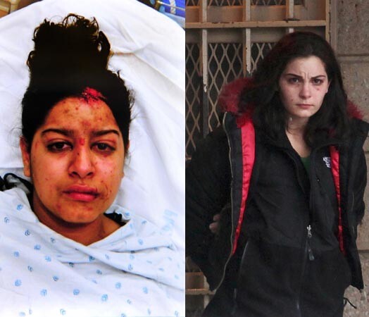 Мелани Спанопоулос два раза переехала свою двоюродную сестру, и теперь Жизель Пенагос предстоит серьезное лечение