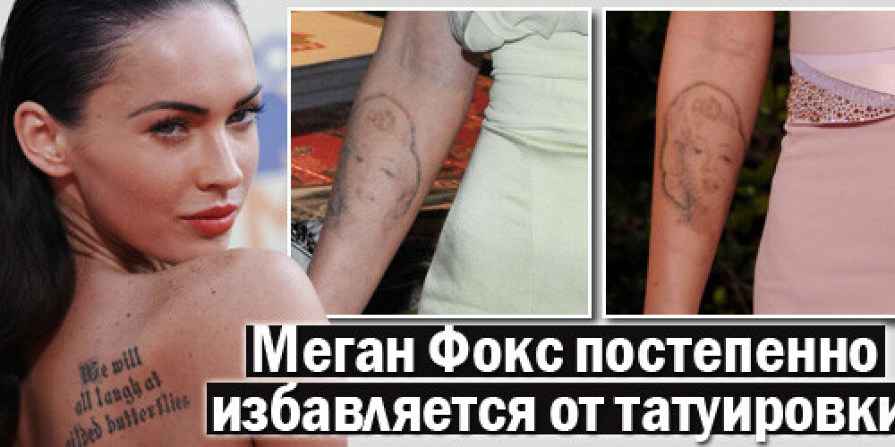 Меган Фокс постепенно избавляется от татуировки