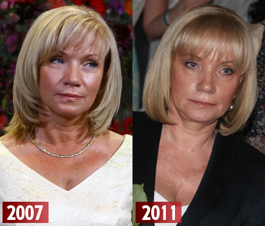 Lilita Zatlere 2007. gadā un 2011. gada jūnijā, dēla Kārļa izlaidumā Rīgas Humanitārajā vidusskolā.