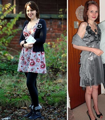 Кэтрин уверяет, что теперь ест завтрак, обед и ужин. Она знает, что анорексия не ушла, но теперь она под контролем