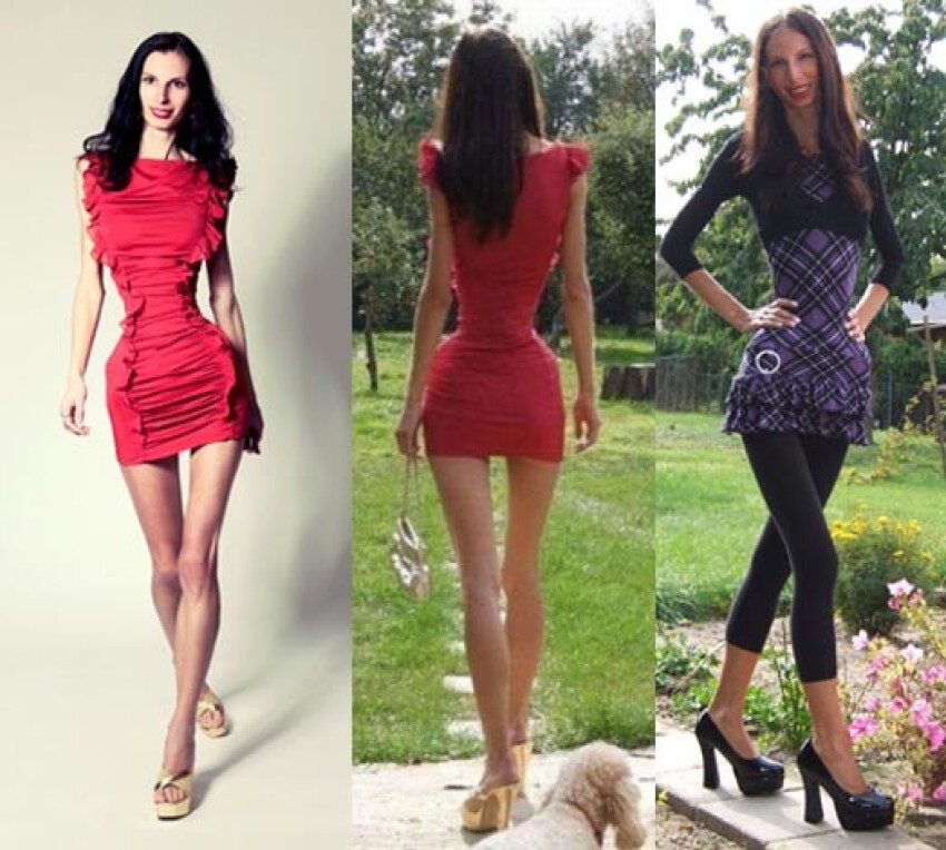 Худые Ноги Платья фото 3