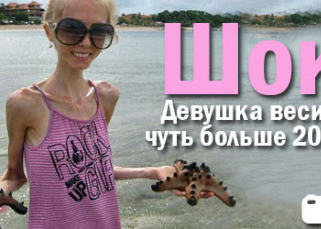 Девушка весит чуть больше 20 кг!