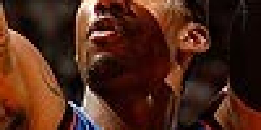 NBA zvaigzne Stademaiers pēc zaudējuma izsit stiklu, pamatīgi sagriežot roku
