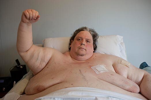Самый толстый мужчина мира очень хочет похудеть.