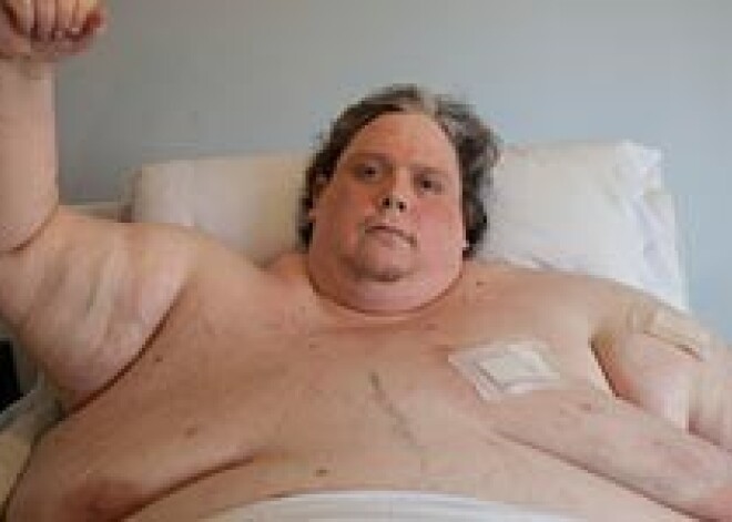 Самый толстый мужчина мира чудовищно несчастен