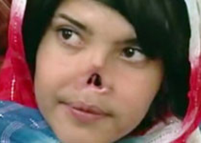 Девушка, потрясшая мир, не может справиться с посттравматическим шоком