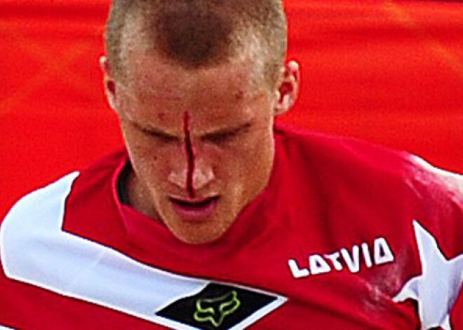 Treimanim pārsists deguns un nobrāzumi, smadzeņu satricinājuma neesot. FOTO