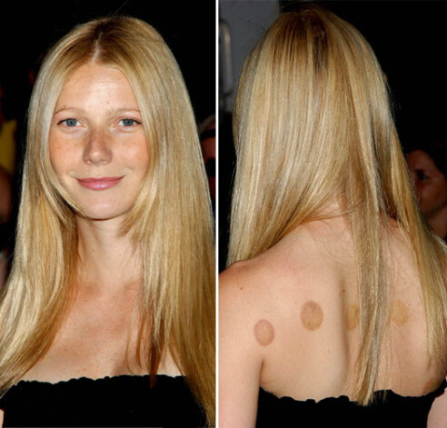 Обладательница «Оскара» Гвинет Пэлтроу — одна из самых больших поклонниц банок и демонстрировала следы лечения даже на кинопремьере