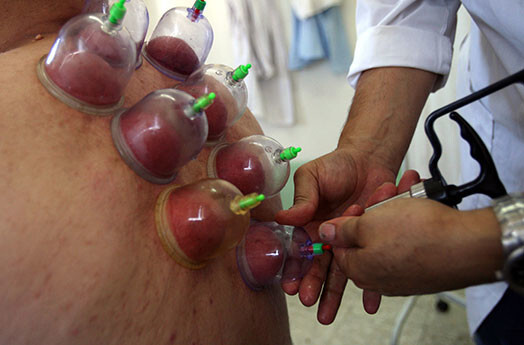 Процедура лечения банками