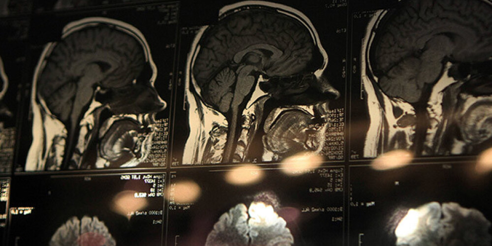 Инновация 15-летнего Джека Андрака диагностирует наличие злокачественной опухоли в 168 раз быстрее, а стоит она в 26 тысяч раз дешевле любой другой проверки.