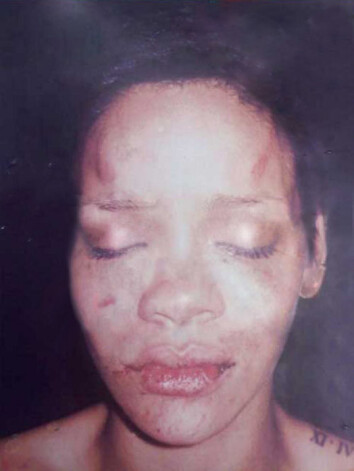 Рианна после избиения