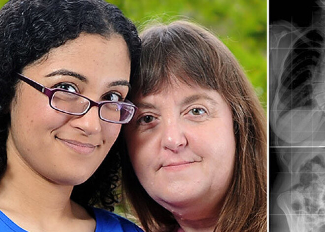 Девушка наконец может жить без боли