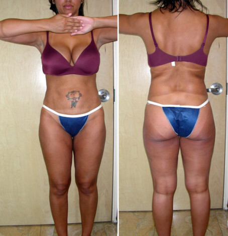 Так женщина выглядела до судьбоносной встречи с Дэвидом