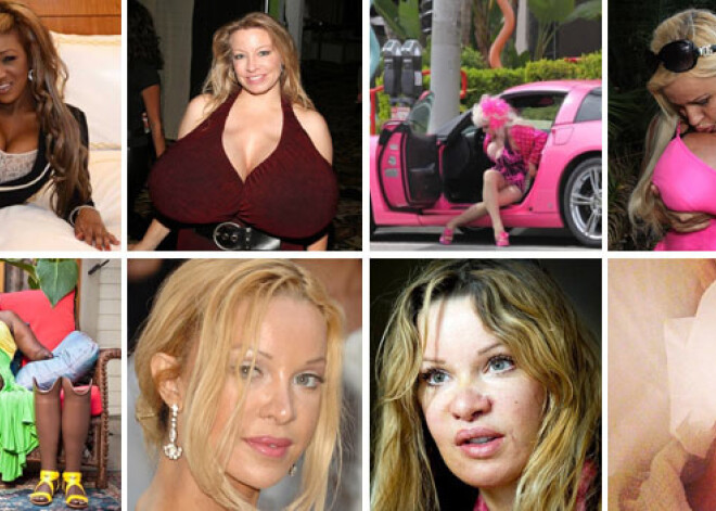 Gada iespaidīgākie plastikas ķirurģijas pārspīlējumi un sekas. TOP 10