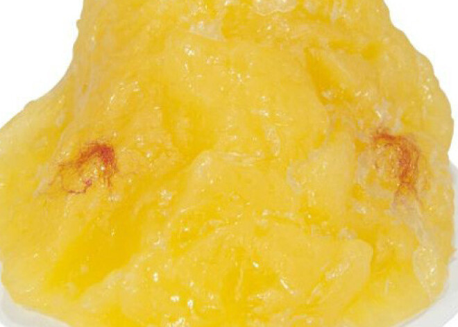 Как выглядит один килограмм человеческого жира?