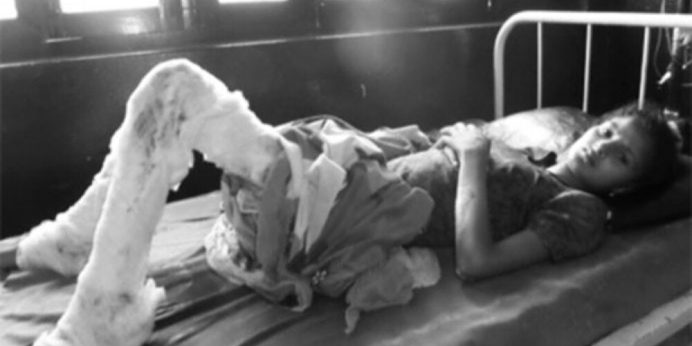 Риана Шек Дхафали потеряла ребенка и проходит лечение в больнице Катманду после ужасающего бесчеловечного нападения