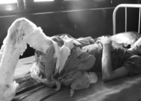 Риана Шек Дхафали потеряла ребенка и проходит лечение в больнице Катманду после ужасающего бесчеловечного нападения