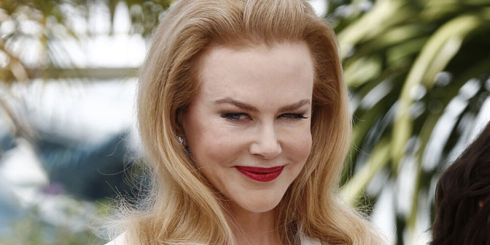 Лицо австралийской актрисы Николь Кидман выглядит неузнаваемым