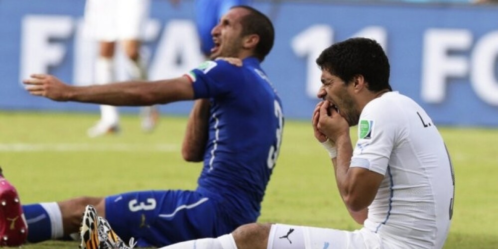Скандальный момент: укушенный итальянец Джорджио Кьеллини  и Луис Суарес после удара в лицо