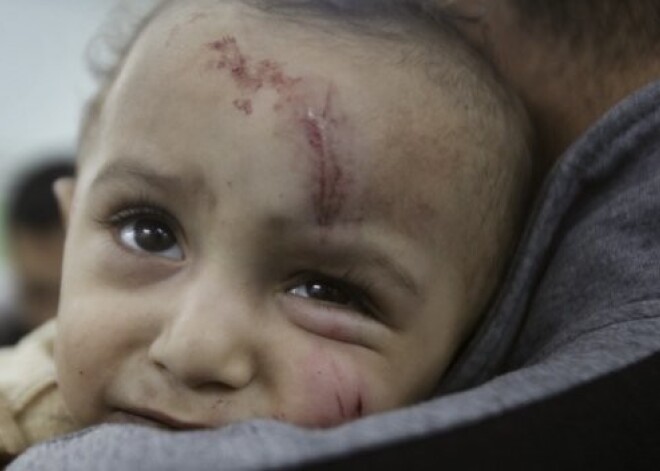 Izraēla Gazas joslā slepkavo mierīgos iedzīvotājus, arī mazus bērnus. FOTO