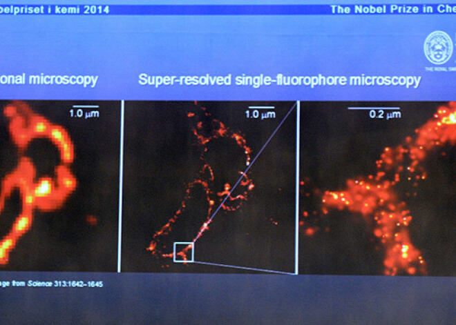 Nobela prēmija ķīmijā - par pētījumiem mikroskopijā