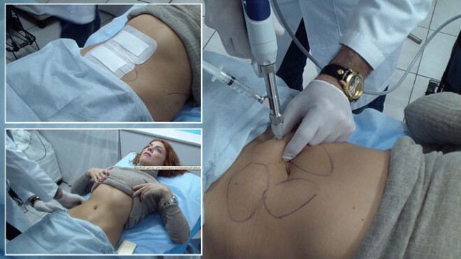 Старт дан: Анастасия Стоцкая уже пережила первую процедуру