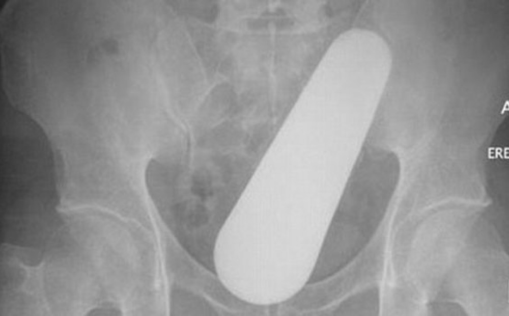 Плохая дама отгребла в анус и во влагалище Плохая дама отгребла в анус и во влагалище