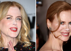 Nedienas ar atstarojošo pūderi aktrisi Nikolu Kidmenu piemeklējušas arī agrāk.