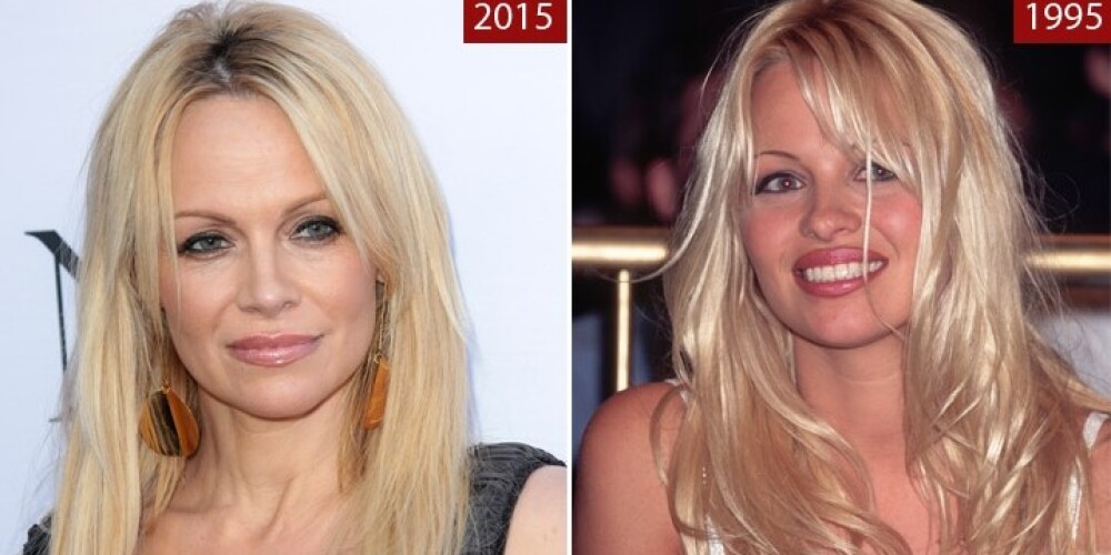 Актриса призналась, что больше не будет прибегать к «инъекциям молодости»