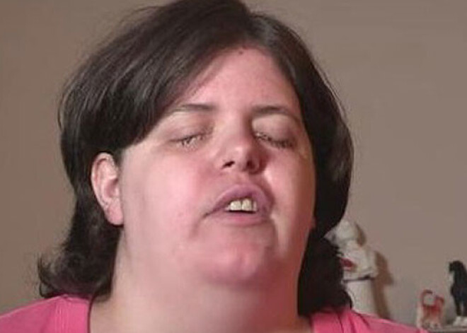 Женщина всю жизнь мечтала быть слепой. ВИДЕО