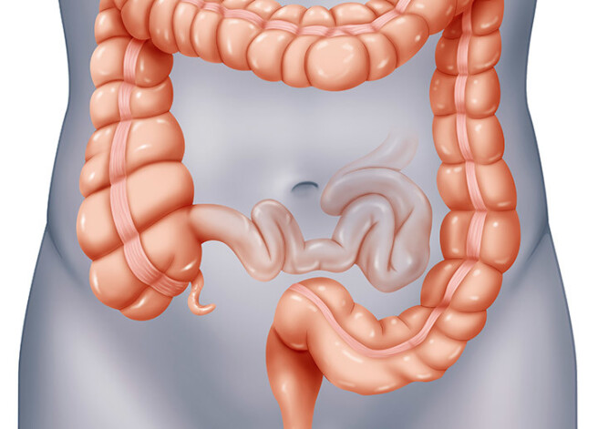 Слишком проницаемые стенки желудка могут способствовать развитию болезней
