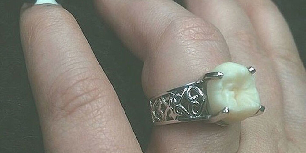 Невеста получила обручальное кольцо с зубом жениха