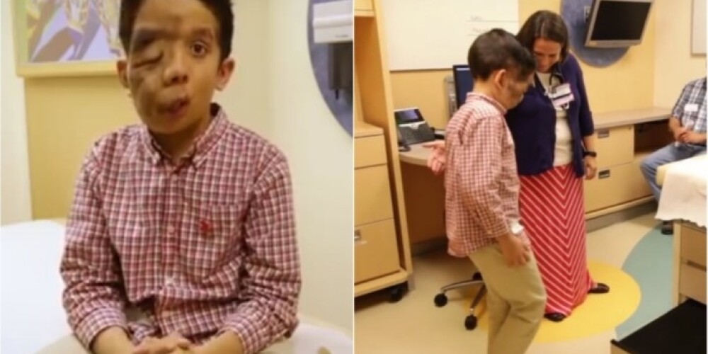 11 gadus vecs zēns ar apbrīnojami stipru garu un dzīvessparu. VIDEO