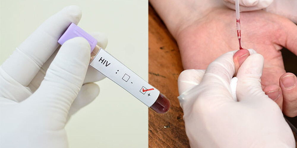 Vīruss, kas maina dzīvi. Latvijā ar HIV ik gadu inficējas 300 cilvēki