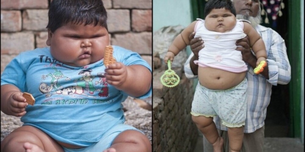 Prātam neaptverami: pusotra gada vecumā šī meitenīte sver 25 kilogramus. VIDEO