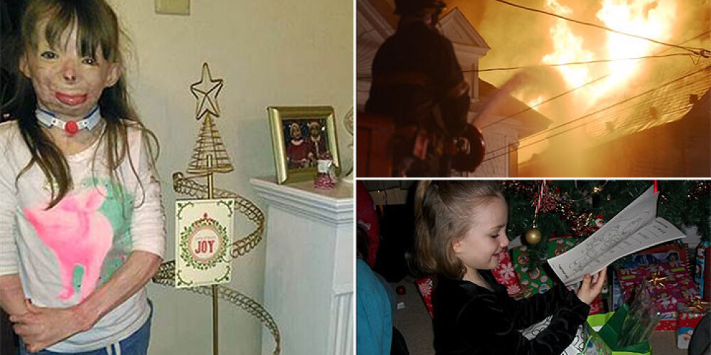 Meitenīte, kas ugunsgrēkā zaudēja visu, šajos Ziemassvētkos vēlas pavisam nedaudz