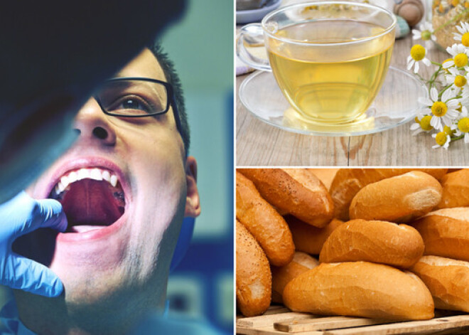 Ko iesākt, ja mutē bieži ir čūlas? Tās var liecināt par veselības traucējumiem vai nepareizu uzturu