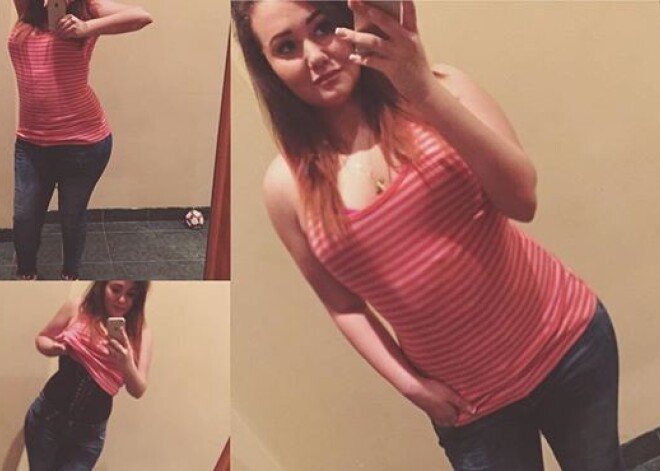 Дочь Иосифа Пригожина решилась на липосакцию