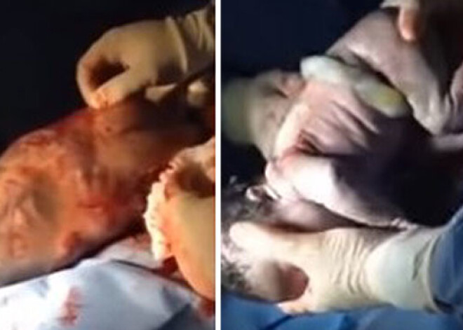 Невероятный момент — ребенок, родившийся «в рубашке». ВИДЕО