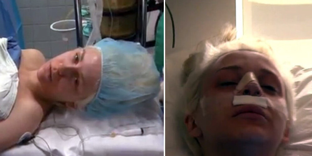 Юная секс-бомба исправила форму носа под прицелом телекамер
