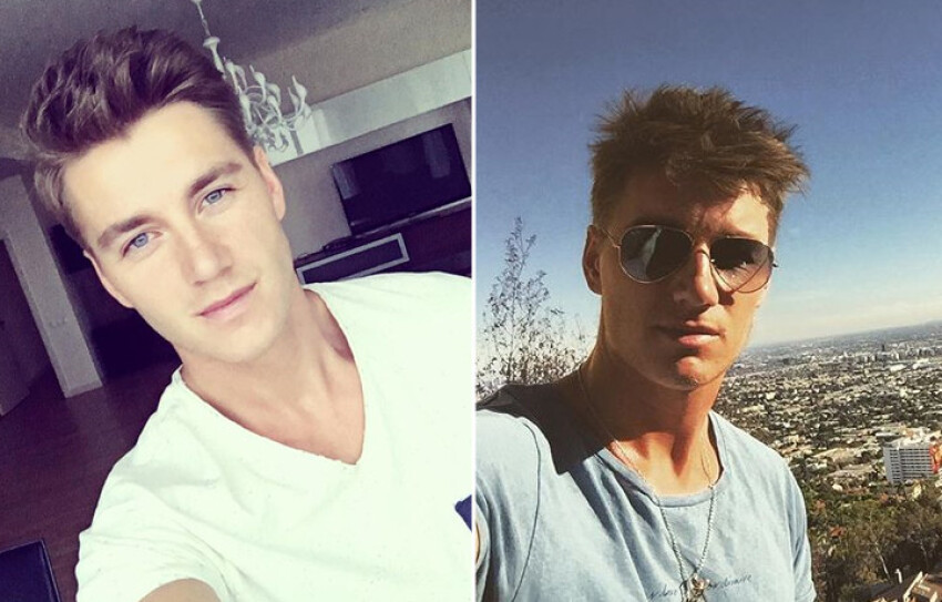 Воробьев до и после пластики Воробьев до и после пластики